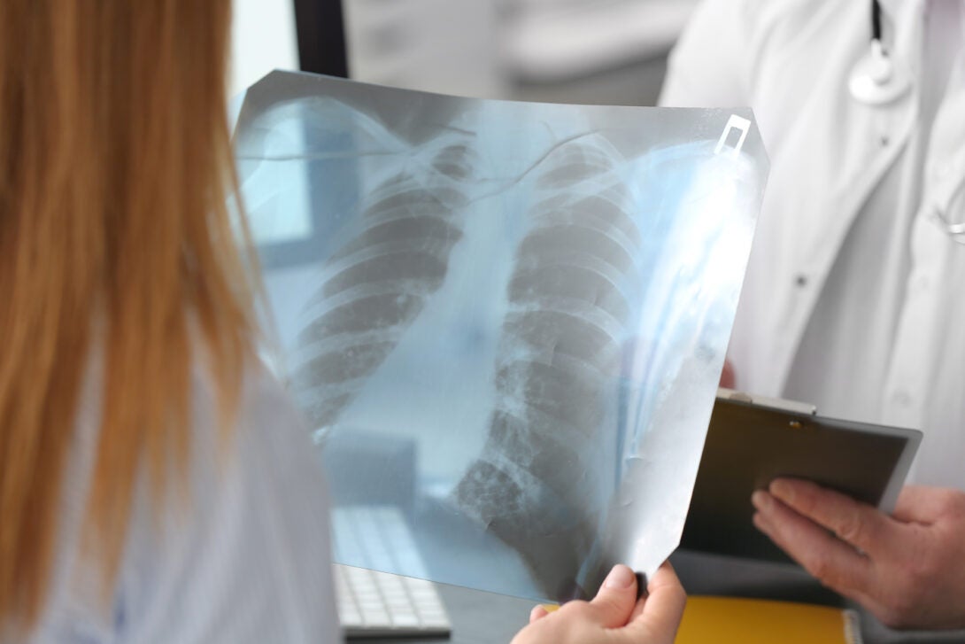 Medical providers looking at chest x-ray